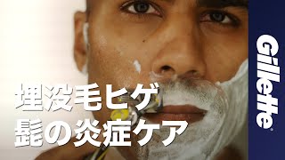 【髭剃りやり方💈】埋没毛ヒゲの対策と髭の炎症ケア｜ジレットカミソリでの髭の伸ばし方と手入れの方法