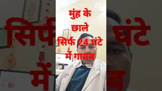 क्या लगाने से  24 घण्टे में मुंह के छाले गायब हो जाते हैं #health#viral#shorts#mouthulcer#trending#