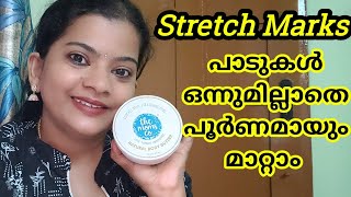 6 മാസം ഉപയോഗിച്ച് stretch marks മാറ്റിയെടുക്കാം | The Mom's Co The Natural Body Butter | Review