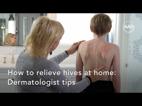 What can you put on a rash to make it better?