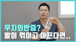 [평촌서울나우병원] 무지외반증, 어떤 질환일까?