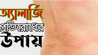 অ্যালার্জি প্রতিরোধের উপায় |How To Relive ALLERGY | অ্যালার্জি দূর করার উপায় |TipsBangla