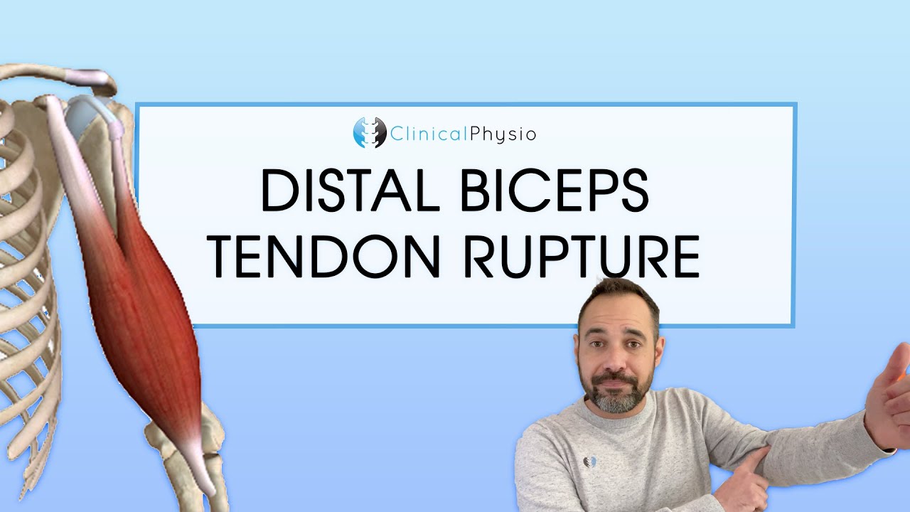 Distal Biceps Tendon Rupture | Expert Physio Review - YouTube