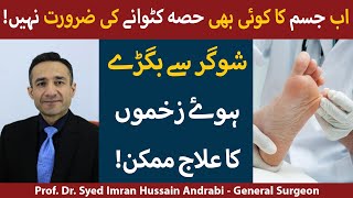Sugar Ke Zakham Ka Ilaj In Urdu |What Is Diabetic Foot Ulcer | Diabetic Foot Ulcer Treatment In Urdu