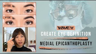 How To Make Your Eyes Look Bigger | Eye Enlargement  at Wave Plastic Surgery