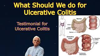 How to get Rid of Ulcerative Colitis? And Testimonial || Dr Khadar | Dr Khadar Lifestyle