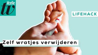 Zelf wratjes verwijderen - Libelle Lifehack