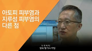 아토피 피부염과 지루성 피부염의 다른 점 - (20150325_539회 방송)_건조한 봄, 지루성 피부염을 조심하라