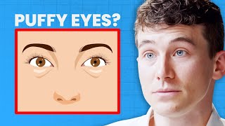 Eye Doctor REVEALS How to Get Rid of Under EYE BAGS | Dr. Joseph Allen