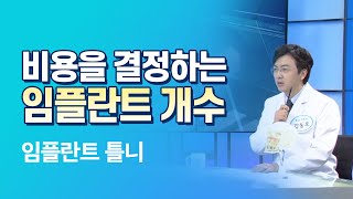 비용걱정되는 임플란트 수술, 적당한 식립개수는? 4개? 9개?