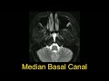 skull base anatomy