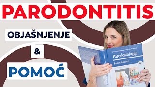 PARODONTITIS - što vam se zapravo događa i kako se liječi ova bolest - odgovori na najčešća pitanja