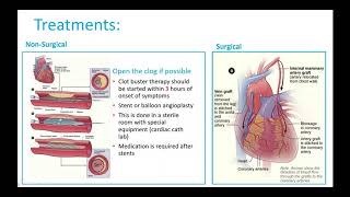 In Control Webinar 1 - The Basics of Heart Failure