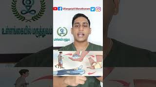 கணுக்கால் சுளுக்கு முதலுதவி சிகிச்சை | Ankle sprain first-aid| எண்ணெய் வைத்தியம் ஏன் செய்ய கூடாது