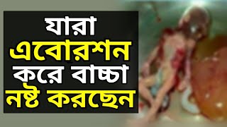 যারা এব্রোশন করে বাচ্চা নষ্ট করার চিন্তাভাবনা করছেন তারা একবার হলেও শুনুন |