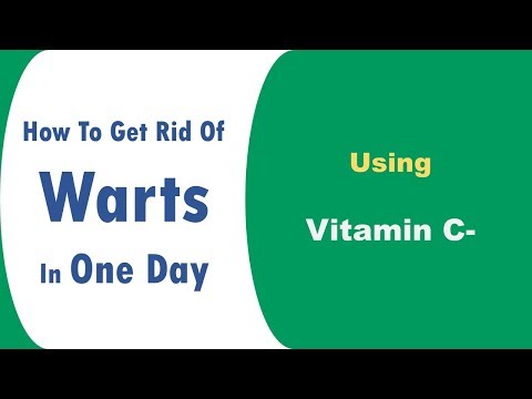 how to get rid of warts in one day using Vitamin C how to get rid of warts in one day using Vitamin C