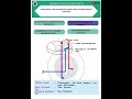 vertebral injury key pattern explained neurology medical edu