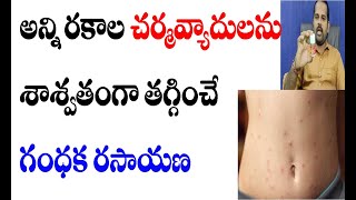 అన్ని రకాల చర్మ వ్యాదులను శాశ్వతంగా తగ్గించే గంధక రసాయణ | gandak rasayan uses | skin diseases remedy