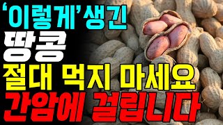 땅콩 몸에 좋다고 아무거나 먹으면 생기는일 '이렇게' 생긴 땅콩 먹으면 간암에 걸립니다.