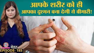 क्यों हो जाती हैं Autoimmune diseases जिसमें अपनी Immunity दुश्मन बन जाती है | Sehat ep 185