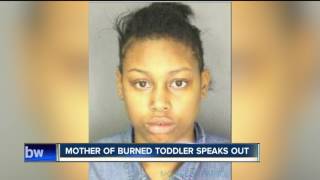 Mother of burned toddler speaks out