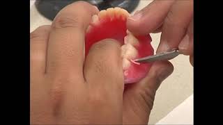 COMPLETE DENTURE: 12. Contouring and Finishing of Wax Surfaces in Complete Denture