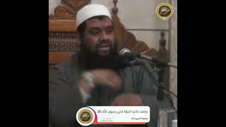 وصف خاتم النبوّة لدى رسول اللّٰه ﷺ