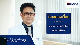 The Doctors : การรักษาโรคสมองเสื่อม