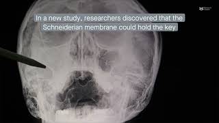 Stem cells in maxillary sinus promote new bone growth