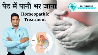 Ascites Homeopathic Treatment | Symptoms, Causes, & Homeopathic Medicines | Dr. Sunil Patidar