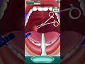 tonsil operation with cuts ✂️ medical demo animation 🤔💜 ASMR Satisfying relaxing game #viralshort