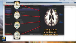 CONN Tutorial #9: Group-Level Analysis