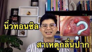 นิ่วทอนซิล สาเหตุกลิ่นปาก | นพ วีระชัย ศรีมหาโกศล l สาระน่ารู้เพื่อสุขภาพ หมอแมนสตอรี่ EP.5