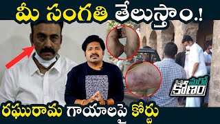 తనను కొట్టారని రఘురామ ఫిర్యాదు.. సీఐడీ సంగతి తేలుస్తామన్న కోర్టు | RRR Complaints on CID