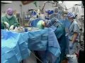 global news story dr sanjiv gandhi pediatric heart surgeon