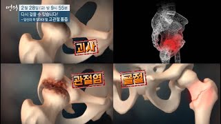 [명의] 다시 걸을 수 있습니다! - 당신이 꼭 알아야 할 고관절 통증