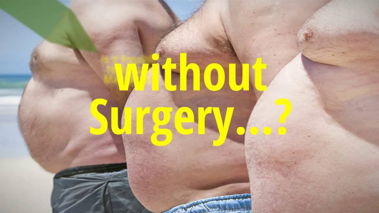 Gynecomastia Surgery Chicago Cost - Surgeon Cost - YouTube