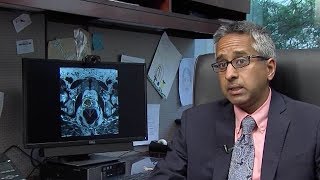 Prostate screening guidelines? Penn State Cancer Institute