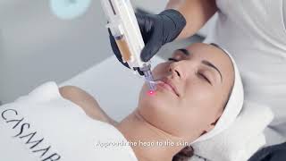 MICRONEEDLING UKR