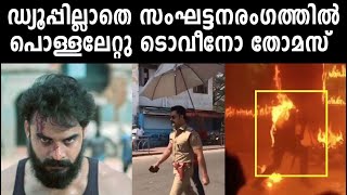 നടന്‍ ടൊവിനോ തോമസിന് പൊള്ളലേറ്റു  | filmibeat Malayalam