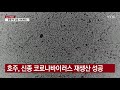 호주 신종코로나 바이러스 재생산 성공...백신개발 첫 단추 ytn