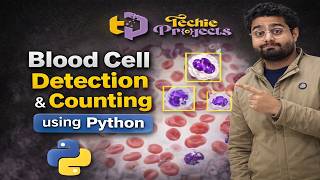 Blood Cell Classification using Image Processing | Blood Cell Detection and Counting using Python