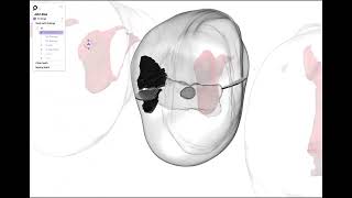 Perceptive Completes Successful Clinical Study of World’s First 3D Intraoral OCT Dental Imaging...