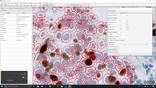 4 - Cell detection vs Positive cell detection