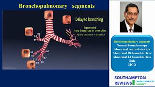 Bronchoscopy 1