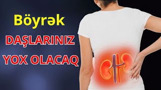 Böyrək Ağrılarınızı Bir Həftəyə Yox Edəcək