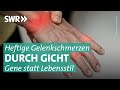 Schlechte Ernährung bei Gicht nicht die Ursache? Neue Erkenntnisse! | Doc Fischer SWR