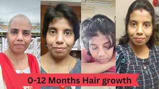 month 0 to month 12 hair growth || headshave || headshave  telugu