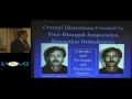 dr. gerald smith discusses the dental whole body connection at iaomt 2010 galloway