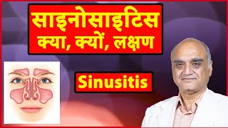 What is sinusitis । साइनोसाइटिस क्या है। साइनस किसे कहते हैं। Hindi